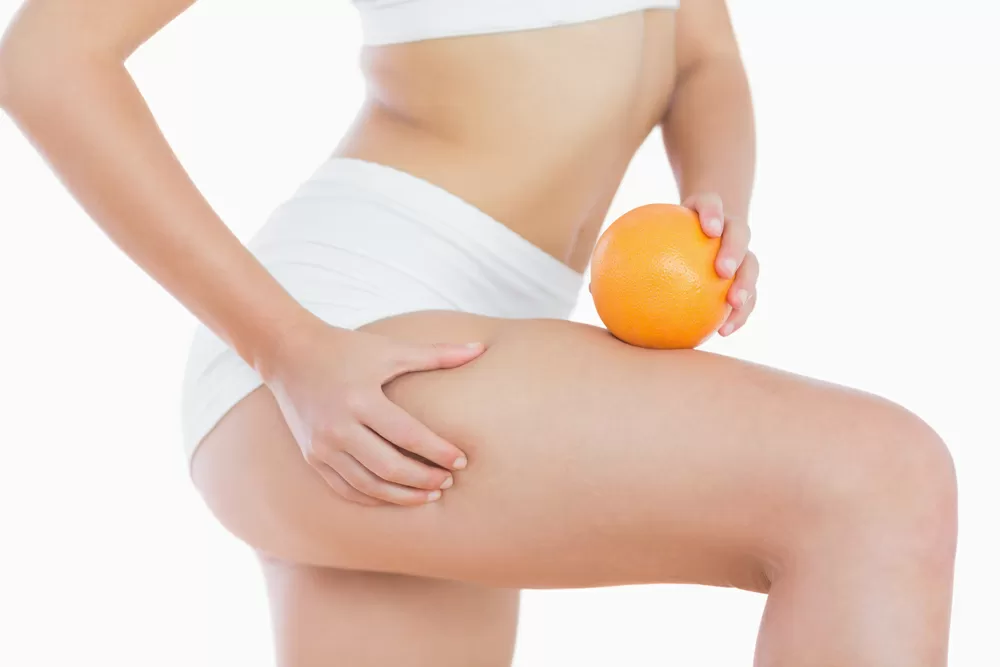 kako se resiti celulita